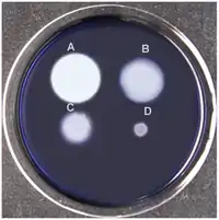 Amylase test results