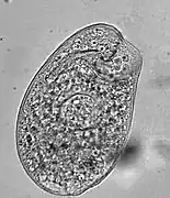 Climacostomum (Climacostomidae)