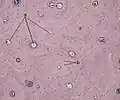 Hueso compacto: a. Conductos de Havers, b. Lagunas con osteocitos