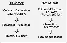 Etiology and pathobiology of Idiopathic Pulmonary Fibrosis (IPF)