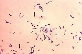 Corynebacterium diphtheriae