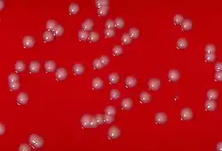 Corynebacterium ulcerans