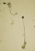 Dictyostelium, 5-cuerpos fructíferos