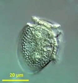 Dinophysis acuminata (Dinoflagellata, Alveolata)