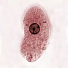 Entamoeba histolytica (Archamoebea)