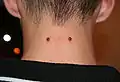 Nape piercing: aquella que se realiza en la nuca.