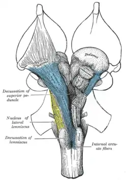 Profunda disección del Tronco encefálico. Vista ventral.