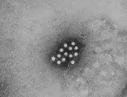 Hepatitis A (Picornaviridae)