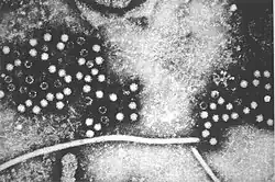 Hepatitis E (Hepevirus)