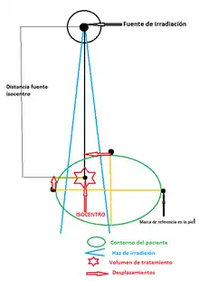 Isocentro en el paciente