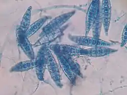 Macroconidios de M. canis