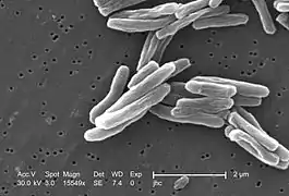 Mycobacterium tuberculosis