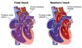 Circulación cardiaca neonatal