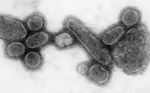 Influenza virus