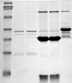 Se trata de una electroforesis en gel SDS en la que se observa, a la izquierda, un patrón de bandas modelo, y el patrón de badas de tres proteínas más.