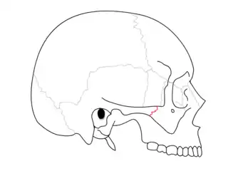 Sutura temporocigomática