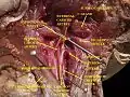 Músculos, arterias y nervios del cuello. Disección del recién nacido.