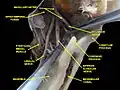 Fosa infratemporal. Nervio lingual y alveolar inferior. Disección profunda. Vista anterolateral