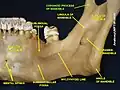 Apófisis coronoides mandibular