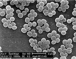 Staphylococcus aureus