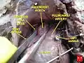 Aorta ascendente fetal