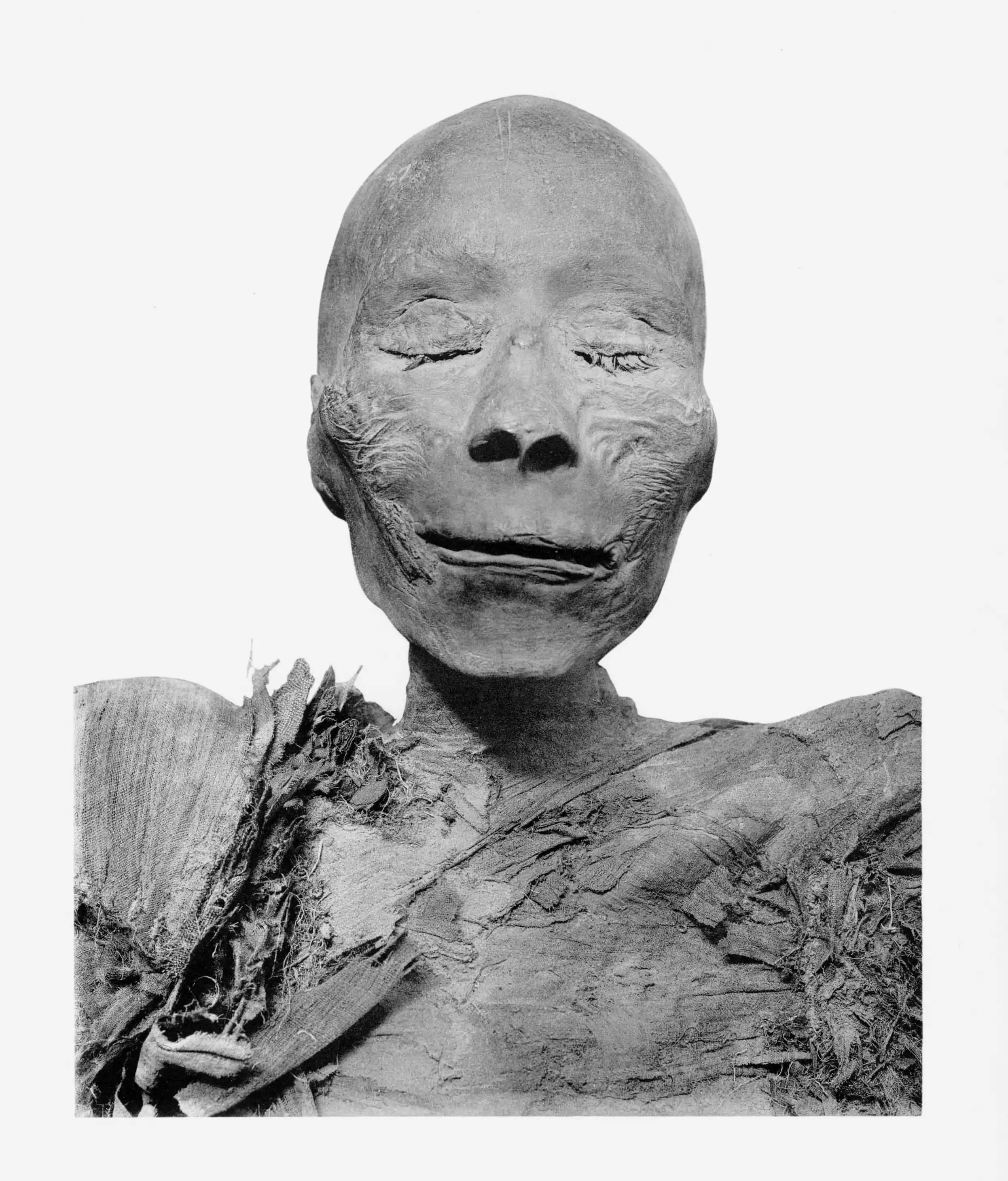 Thutmose_I_mummy_head