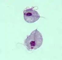 Trichomonas vaginalis (Parabasalia, Metamonada)