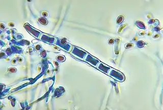 Macroconidios de T. rubrum