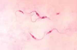 Trypanosoma cruzi (Euglenozoa)