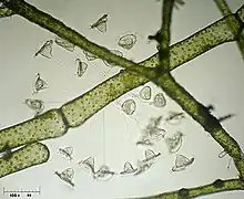 Vorticella campanula (Sessilida)