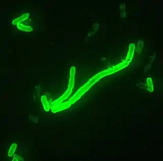 Tinción fluorescente, aumentada 200 veces