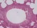 Bronquiolo de ratón visto al microscopio