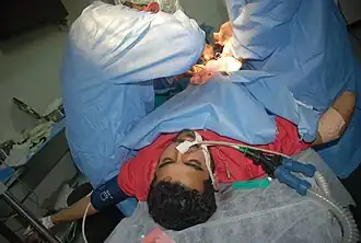 Rebelde herido en el hospital de Al Baida. Alrededor de 50.000 personas murieron en el conflicto