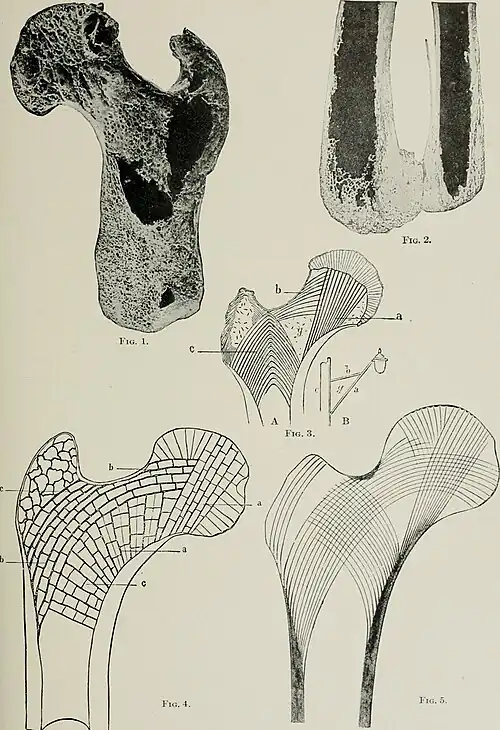 Trabéculas y líneas de tensión de la epífisis superior del Fémur.