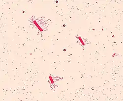 Bacillus cereus (Firmicutes)