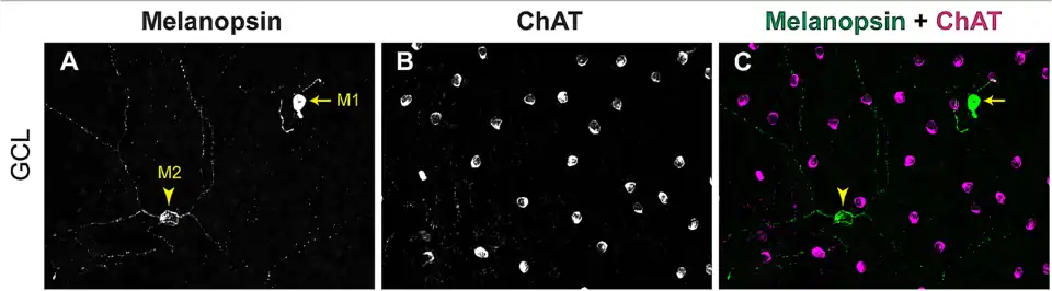 RGC fotosensibles, aumento bajo, en verde (puntas de flecha). Células amácrinas en magenta. Microscopía confocal.