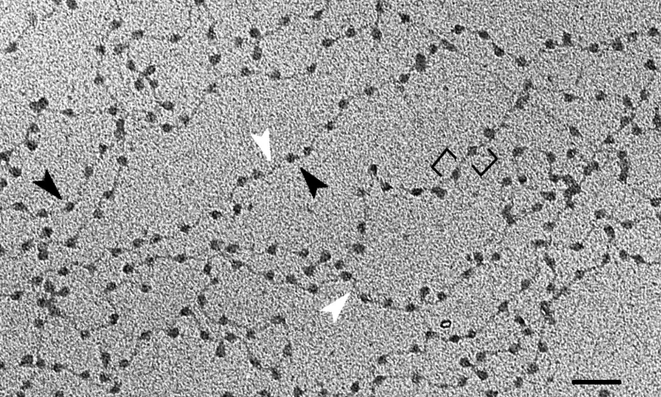 Filamentos de cromatina decondensada de eritrocitos de pollo observada al microscopio electrónico. El encadenamiento de las partículas del nucleosoma (flechas negras) separados por las hebras de ADN de conexión (puntas blancas) ha valido a esta estructura su sobrenombre de «collar de perlas». (Escala: barra= 50 nm.
