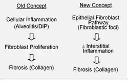 Etiology and pathobiology of Idiopathic Pulmonary Fibrosis (IPF)