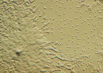 Dictyostelium, 1-mixamebas