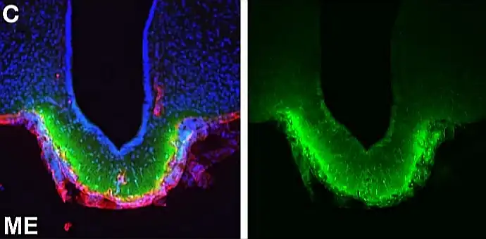 Área peri-capilar teñida (en verde), capilares fenestrados de la zona ventral. Tercer ventrículo= arriba en el centro (en negro). Corte transversal.