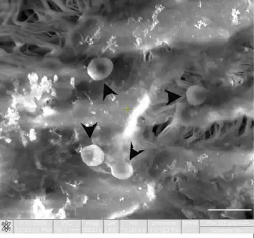 Endoteliales humanas 3D se observan las digitaciones. Glóbulos rojos (puntas de flecha). Microscopio electrónico de barrido.