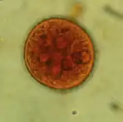 Quiste de Entamoeba histolytica (Archamoebea)