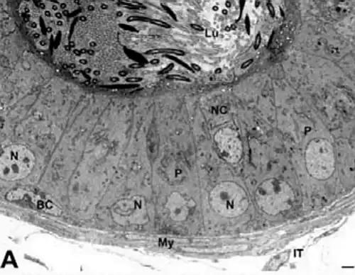 Túbulo del Caput: P= Principal. BC= Basal. NC= No ciliadas. My=mioide. IT= Intersticio tubular. Microfotografía de M.E.