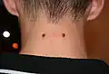 Nape piercing: aquella que se realiza en la nuca.