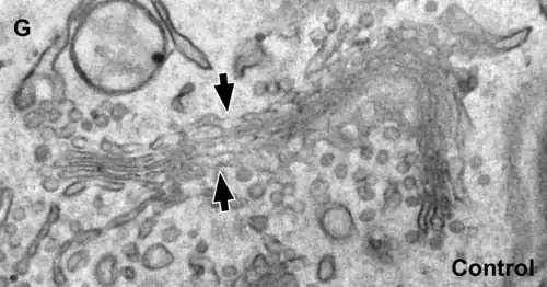 Complejo de Golgi en forma de cinta (ribbon) varias pilas unidas mediante estructuras tubulares (flechas). Célula humana. Microscopio electrónico