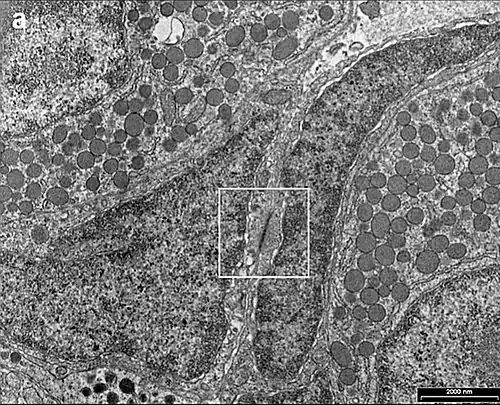 Gonadotropa con vesículas densas (arriba). Células Estrelladas (abajo). Unión Gap comunicante (recuadro). Microscopio electrónico.