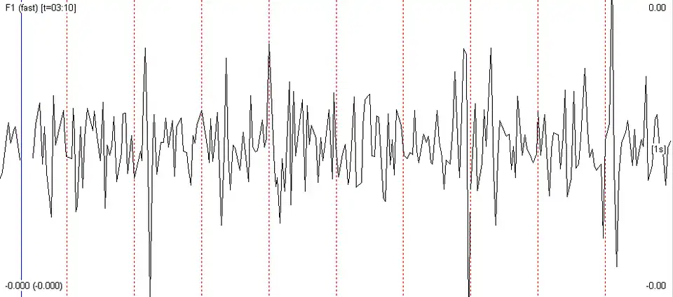 Señal vestibulográmica del movimiento de la cabeza