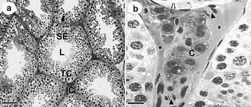 IC= Compartimento del Intersticio (izquierda). C= célula de Leydig (derecha). Microscopio óptico.