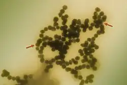 An electron micrograph of spherical nanoparticles clumped together