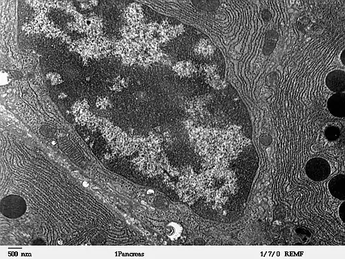 Retículo endoplasmático a la derecha, en una célula secretora. Microscopio electrónico.